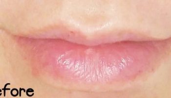 LIPS